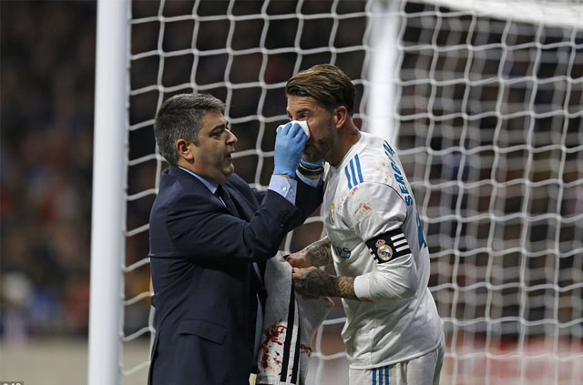 Real Madrid បញ្ជាក់​ហើយ Ramos របួស​បាក់​ច្រមុះ​